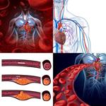 7-buchstaben-antwort-arterie